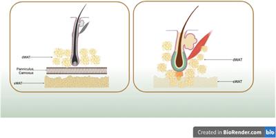 Insights into the unique roles of dermal white adipose tissue (dWAT) in wound healing